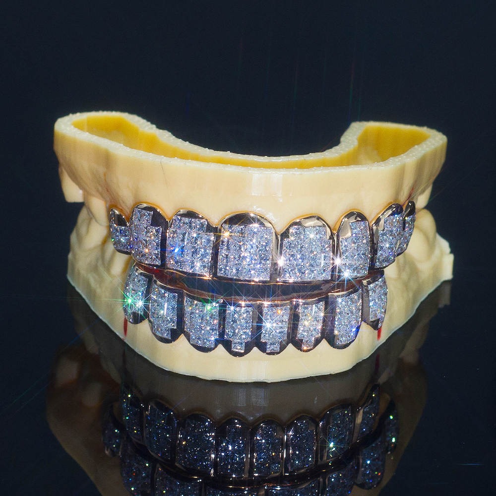 Baguette Moissanite Grillz - Main Image