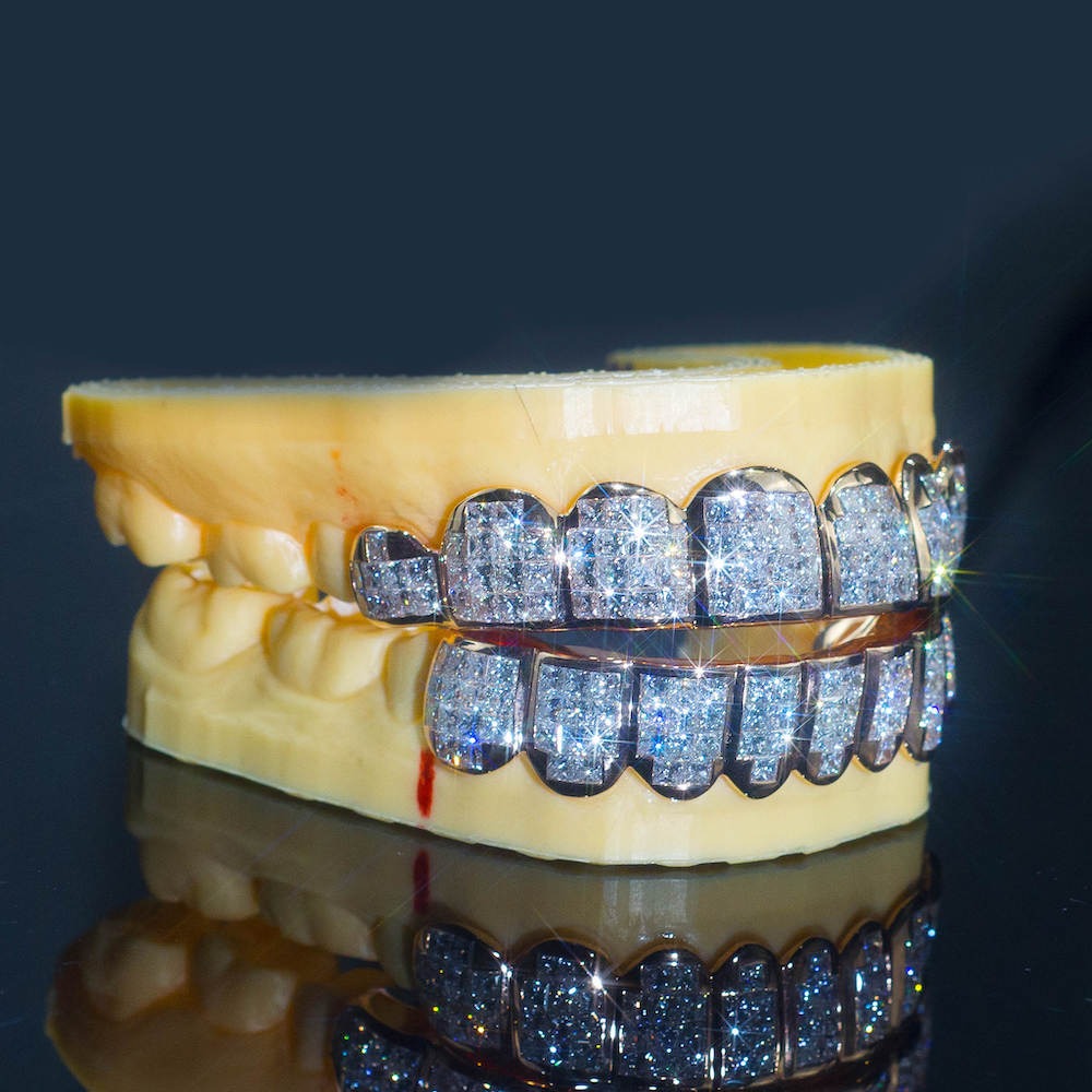 Baguette Moissanite Grillz