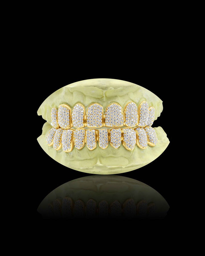 Yellow Moissanite Teeth Grillz