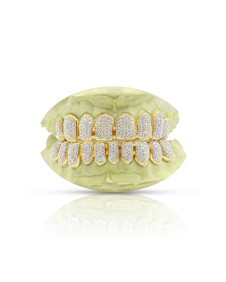 Yellow Moissanite Teeth Grillz